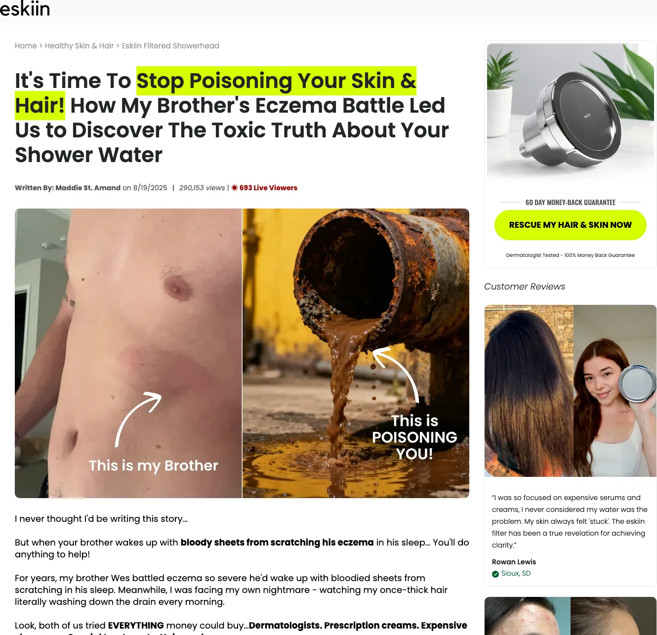 eskiin's advertorial headlined 'It's Time to Stop Poisoning Your Skin & Hair! How My Brother's Eczema Battle Led Us to Discover the Toxic Truth About Your Shower Water,' with before-style photos and a byline