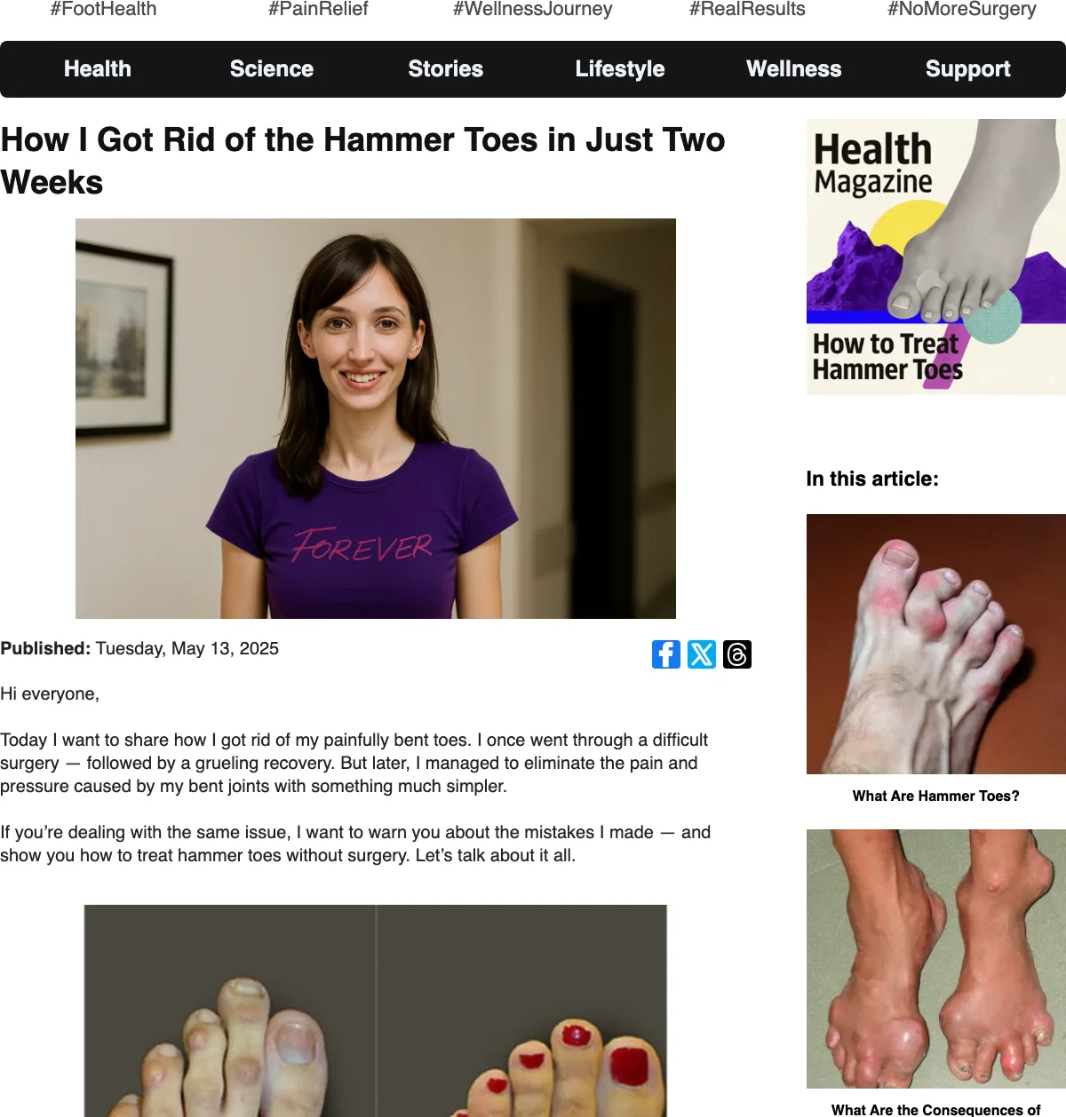 HYGGEAR's first-person advertorial 'How I Got Rid of the Hammer Toes in Just Two Weeks,' styled as a health-magazine article with a personal byline